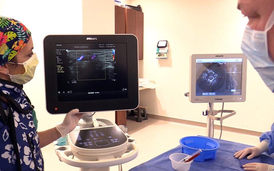 Vein Doctor Near You Columbus-Polaris